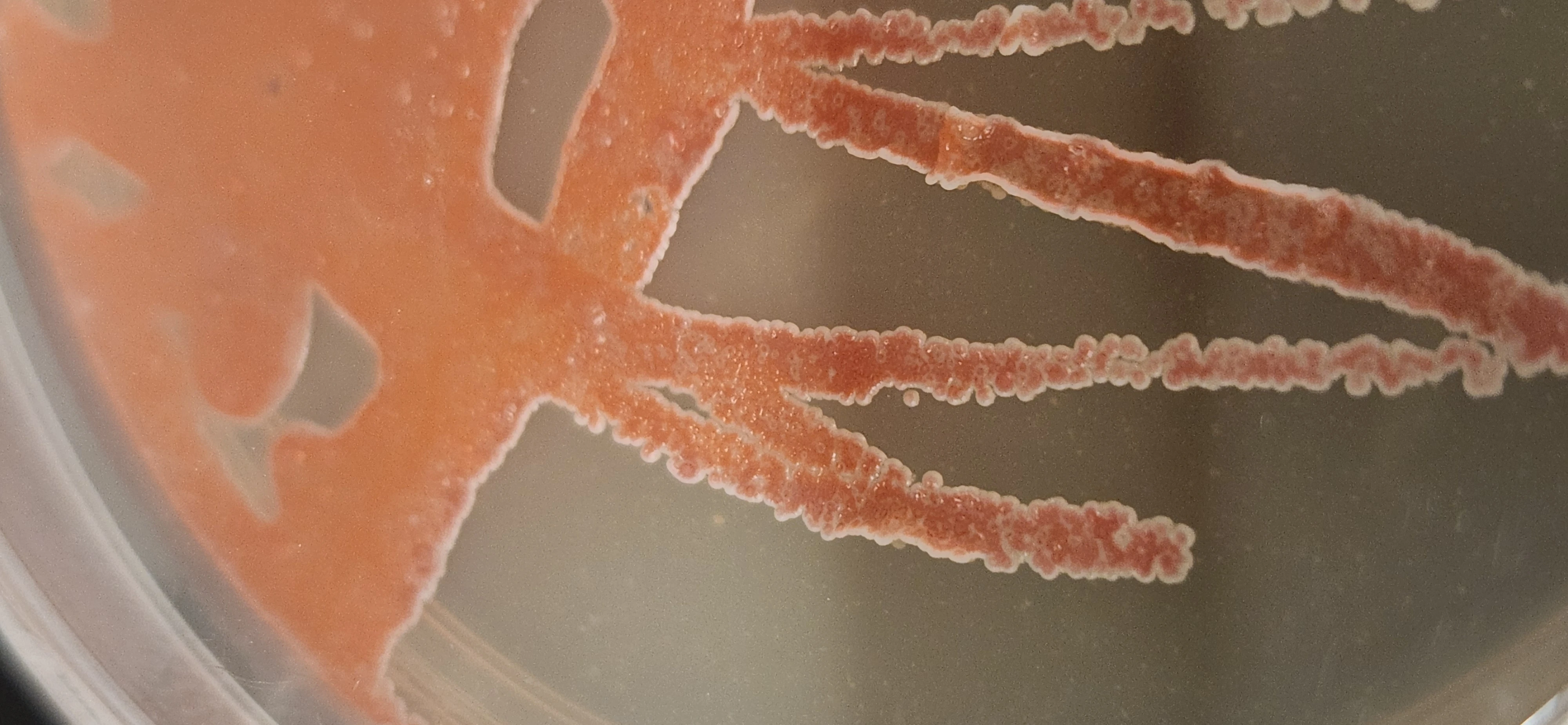 Close-up of an orange-pigmented bacterial streak on agar